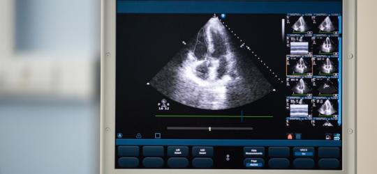 Echo serca - jak wygląda to badanie? Jak się przygotować?
