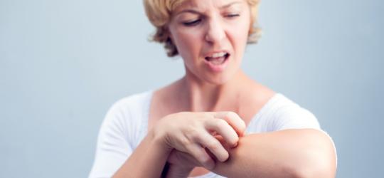 Egzema – co robić, gdy skóra łuszczy się i swędzi?