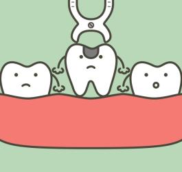 Ekstrakcja zepsutego, niemożliwego do wyleczenia zęba.