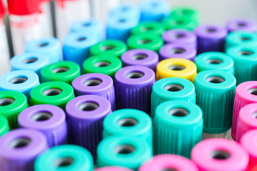 Próbki krwi przeznaczone do badania elektroforezy białek surowicy krwi.