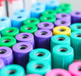 Próbki krwi przeznaczone do badania elektroforezy białek surowicy krwi.