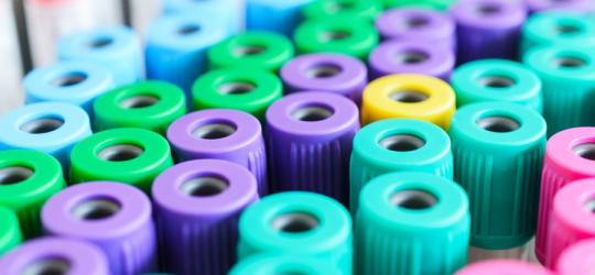 Próbki krwi przeznaczone do badania elektroforezy białek surowicy krwi.