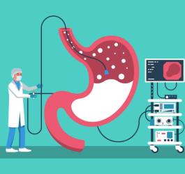 Rysunkowy lekarz przeprowadza endoskopię żołądka.