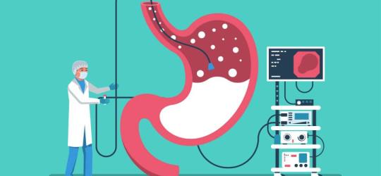 Rysunkowy lekarz przeprowadza endoskopię żołądka.