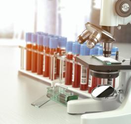 Eozynofile - normy morfologii krwi