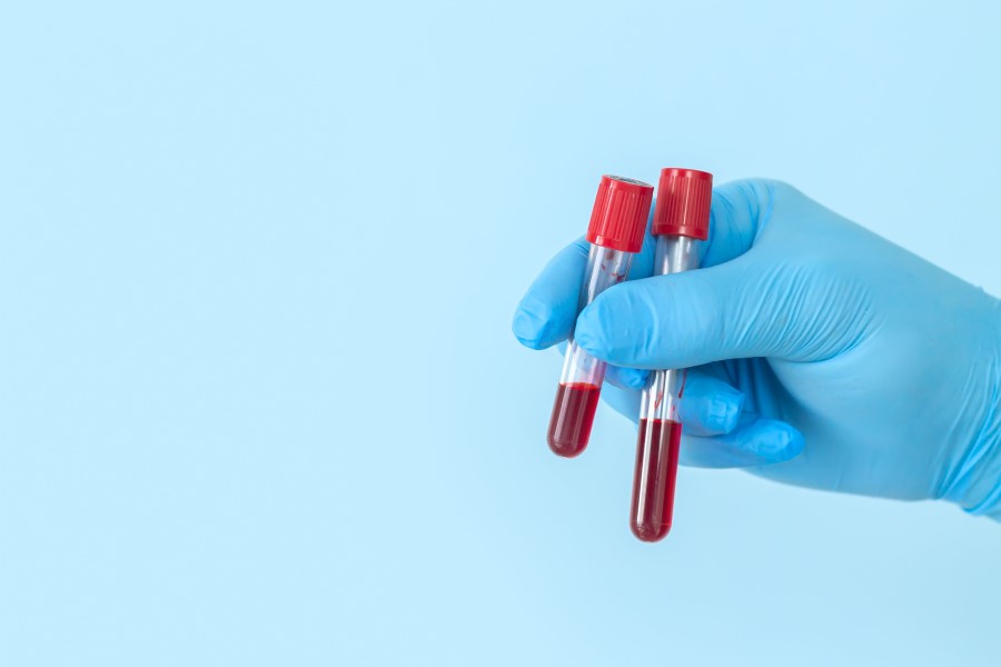 Dłoń w niebieskich rękawiczkach nitrylowych trzyma fiolki z krwią przeznaczoną do badania.