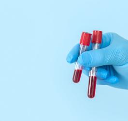 Dłoń w niebieskich rękawiczkach nitrylowych trzyma fiolki z krwią przeznaczoną do badania.