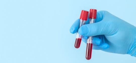 Dłoń w niebieskich rękawiczkach nitrylowych trzyma fiolki z krwią przeznaczoną do badania.