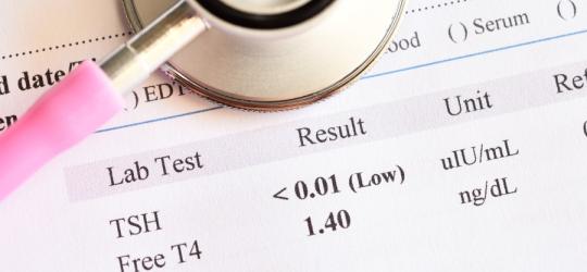Różowy stetoskop lekarski i kartka z wynikiem badań poziomu tyroksyny FT4.