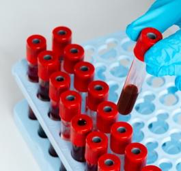 Diagnosta sięga po próbkę krwi, aby zbadać m.in. poziom granulocytów.