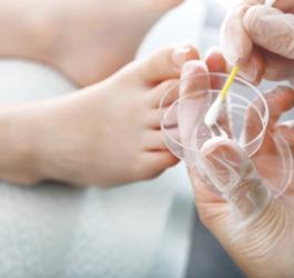 Grzybica skóry - objawy i leczenie