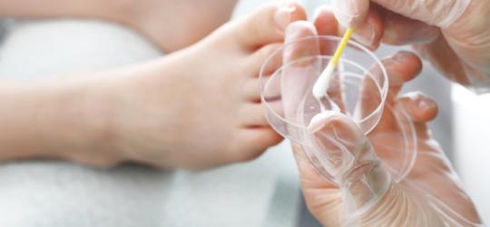 Grzybica skóry - objawy i leczenie