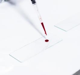 Hematokryt (HCT) – normy