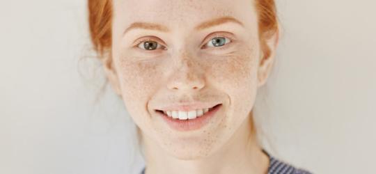 Młoda dziewczyna o rudych włosach, z heterochromią. Uśmiecha się do fotografa.