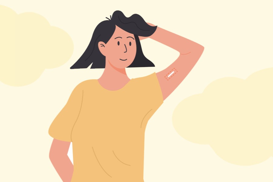 Rysunkowa kobieta ma założony na ramieniu implant antykoncepcyjny.