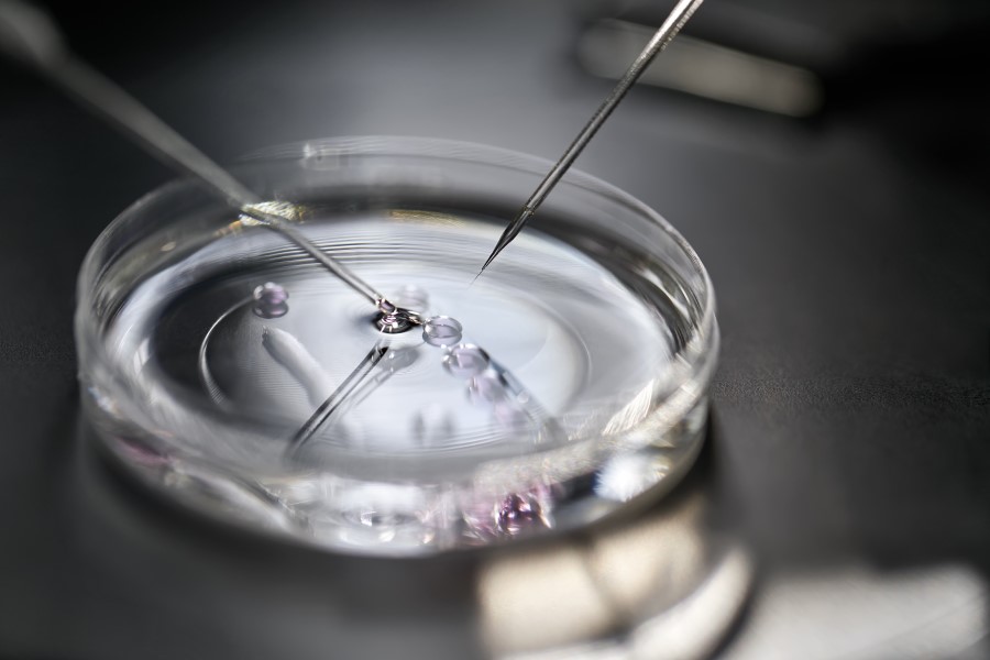 szala Petriego podczas procedury in vitro.