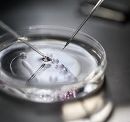 szala Petriego podczas procedury in vitro.