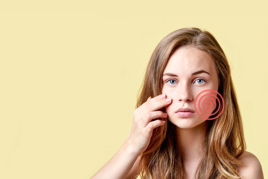 Jak leczyć trądzik różowaty?