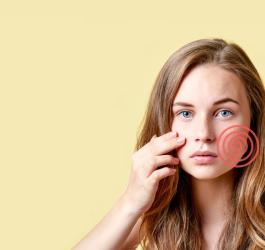 Jak leczyć trądzik różowaty?