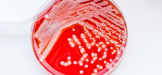 Jak objawia się zakażenie gronkowcem?