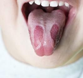 Język geograficzny u kilkuletniego dziecka.