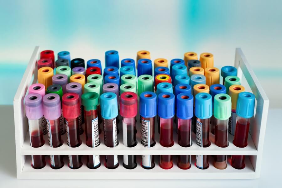 Fiolki zawierające próbki krwi przeznaczone do badania jonogramu.
