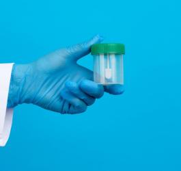 Medyk trzyma w ręce pojemnik potrzebny do pobrania próbki kału.