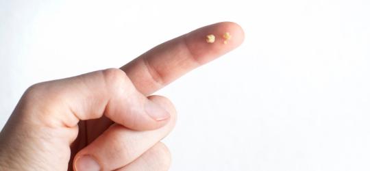 Osoba trzyma na palcu niewielkie kamienie migdałkowe.