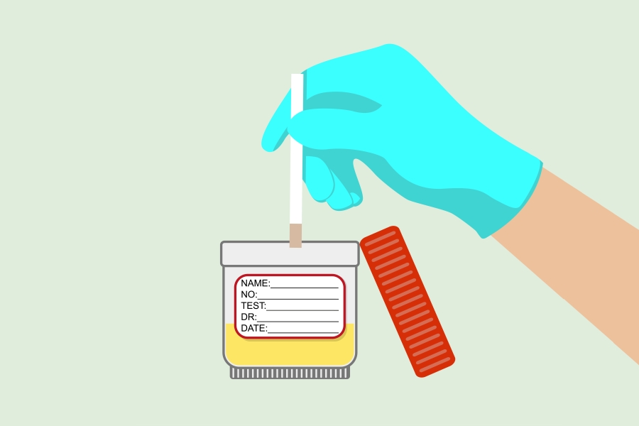 Ketony w moczu - o czym mogą świadczyć?