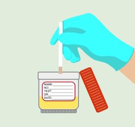 Ketony w moczu - o czym mogą świadczyć?