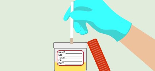 Ketony w moczu - o czym mogą świadczyć?