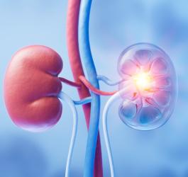 Model 3D nerek, jedna z nich symbolicznie objęta jest stanem chorobowym.