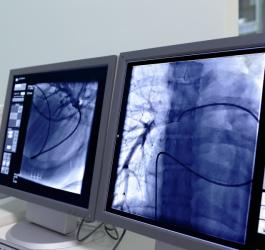 Koronarografia serca - jak się przygotować?