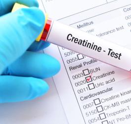 Kreatynina - czym jest?