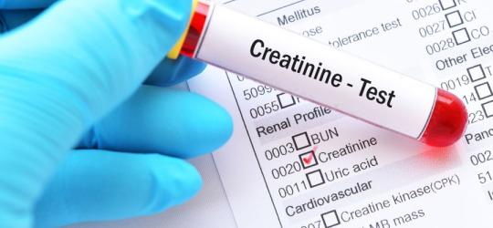 Kreatynina - czym jest?