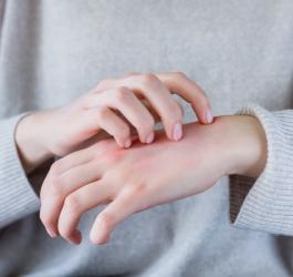 Kobieta ma krosty na rękach, drapie swędząca skórę.