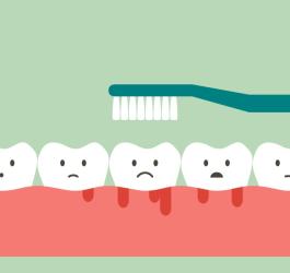 Krwawiące dziąsła podczas szczotkowania.