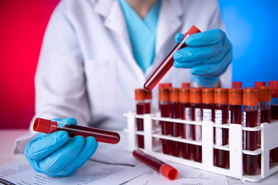 Diagnosta bierze próbki krwi do diagnostyki w kierunku kwasicy metabolicznej.