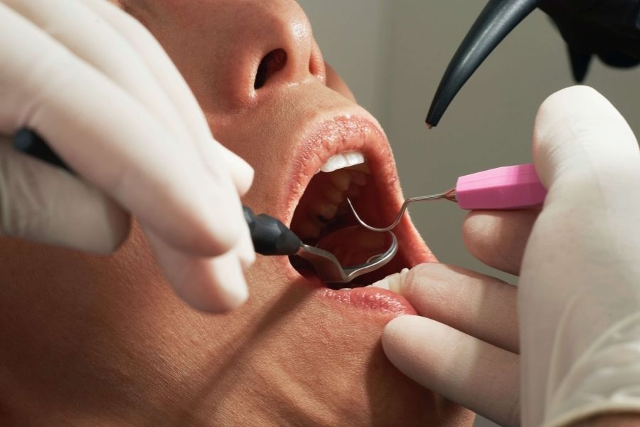 Zbliżenie na twarz pacjenta w trakcie lecenia endodontycznego.