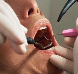 Zbliżenie na twarz pacjenta w trakcie lecenia endodontycznego.