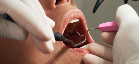 Zbliżenie na twarz pacjenta w trakcie lecenia endodontycznego.