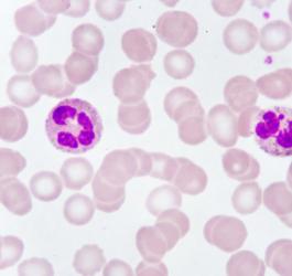 Limfocyty – jaka jest ich rola w organizmie?