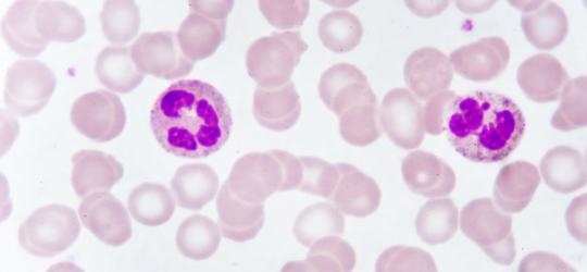 Limfocyty – jaka jest ich rola w organizmie?