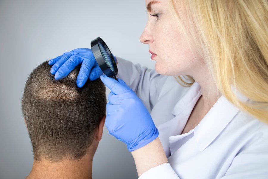 Dermatolożka bada skórę głowy pacjenta, aby ustalić, czy choruje na łysienie plackowate.