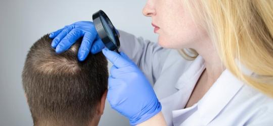 Dermatolożka bada skórę głowy pacjenta, aby ustalić, czy choruje na łysienie plackowate.