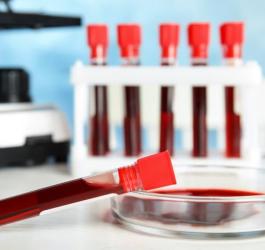 Próbki krwi przeznaczone do badań markerów nowotworowych.
