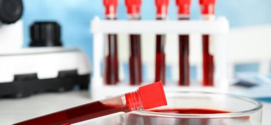 Próbki krwi przeznaczone do badań markerów nowotworowych.