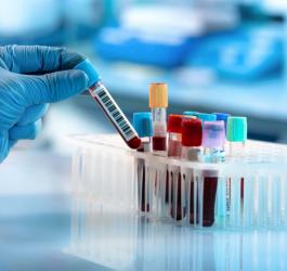 Diagnosta chwyta fiolkę z krwią przeznaczoną do badania morfologii krwi.
