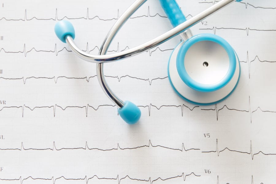 Stetoskop leżący na zapisie EKG, czyli elektrokardiogramie.