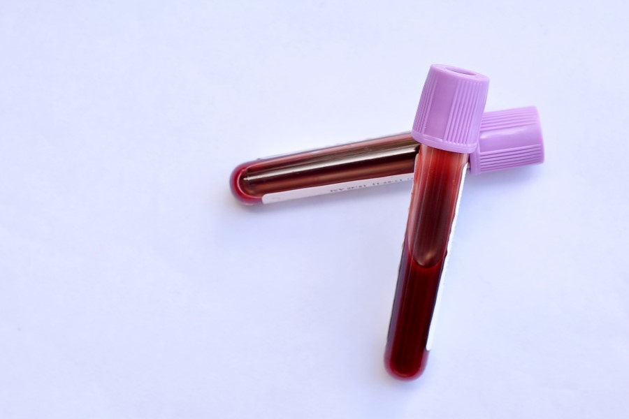 Próbki krwi w fiolkach przeznaczone do badania poziomu mioglobiny.